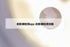 皮肤病检测app 皮肤病检测仪器