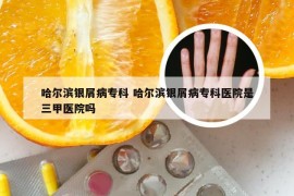 哈尔滨银屑病专科 哈尔滨银屑病专科医院是三甲医院吗