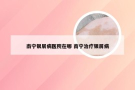 南宁银屑病医院在哪 南宁治疗银屑病
