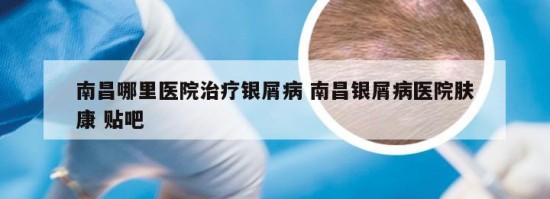 南昌哪里医院治疗银屑病 南昌银屑病医院肤康 贴吧