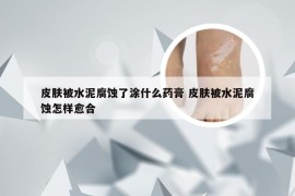 皮肤被水泥腐蚀了涂什么药膏 皮肤被水泥腐蚀怎样愈合