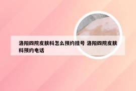 洛阳四院皮肤科怎么预约挂号 洛阳四院皮肤科预约电话