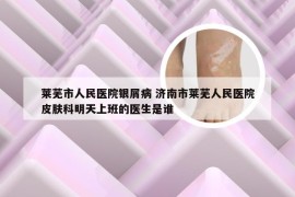 莱芜市人民医院银屑病 济南市莱芜人民医院皮肤科明天上班的医生是谁
