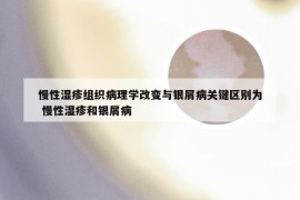 慢性湿疹组织病理学改变与银屑病关键区别为 慢性湿疹和银屑病
