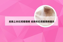 皮肤上长红疙瘩很痒 皮肤长红疙瘩很痒图片