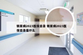 银屑病2023医保目录 银屑病2023医保目录是什么