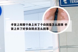 手背上和那个身上长了个白斑是怎么回事 手背上长了好多白斑点怎么回事
