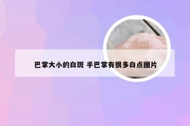 巴掌大小的白斑 手巴掌有很多白点图片