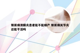 银屑病滑膜炎患者能不能顺产 银屑病关节炎还能干活吗