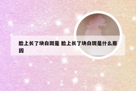 脸上长了块白斑是 脸上长了块白斑是什么原因