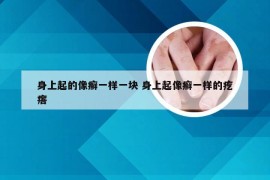 身上起的像癣一样一块 身上起像癣一样的疙瘩
