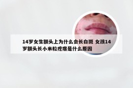 14岁女生额头上为什么会长白斑 女孩14岁额头长小米粒疙瘩是什么原因