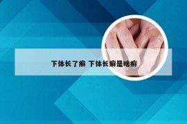 下体长了癣 下体长癣是啥癣