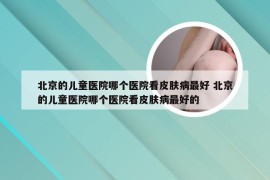 北京的儿童医院哪个医院看皮肤病最好 北京的儿童医院哪个医院看皮肤病最好的