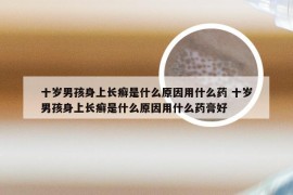 十岁男孩身上长癣是什么原因用什么药 十岁男孩身上长癣是什么原因用什么药膏好