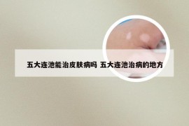 五大连池能治皮肤病吗 五大连池治病的地方