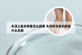 头顶上起白斑是怎么回事 头顶长白色的斑是什么东西