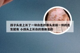 孩子头皮上长了一块白色的像头皮藓一样的出生就有 小孩头上长白的像癣是的
