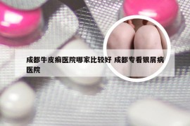 成都牛皮癣医院哪家比较好 成都专看银屑病医院