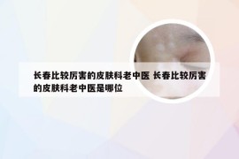 长春比较厉害的皮肤科老中医 长春比较厉害的皮肤科老中医是哪位