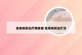 免疫吸附治疗银屑病 免疫吸附治疗法