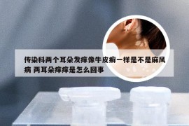 传染科两个耳朵发痒像牛皮癣一样是不是麻风病 两耳朵痒痒是怎么回事