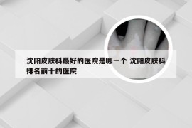 沈阳皮肤科最好的医院是哪一个 沈阳皮肤科排名前十的医院