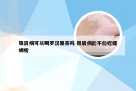 银屑病可以喝罗汉果茶吗 银屑病能不能吃螺蛳粉
