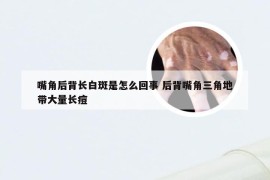 嘴角后背长白斑是怎么回事 后背嘴角三角地带大量长痘