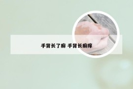 手背长了癣 手背长癣痒