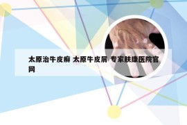 太原治牛皮癣 太原牛皮屑 专家肤康医院官网