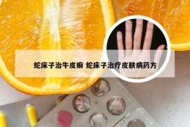蛇床子治牛皮癣 蛇床子治疗皮肤病药方