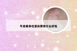 牛皮癣多吃蛋白质有什么好处