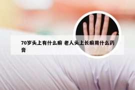 70岁头上有什么癣 老人头上长癣用什么药膏