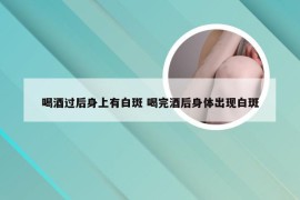 喝酒过后身上有白斑 喝完酒后身体出现白斑