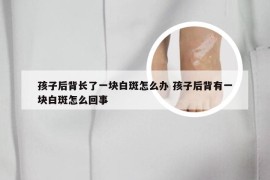 孩子后背长了一块白斑怎么办 孩子后背有一块白斑怎么回事