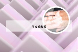 牛皮癣和茶