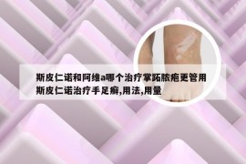 斯皮仁诺和阿维a哪个治疗掌跖脓疱更管用 斯皮仁诺治疗手足癣,用法,用量