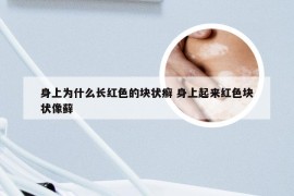 身上为什么长红色的块状癣 身上起来红色块状像藓