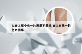 人身上那个有一片黑是不是癣 身上有黑一片怎么回事