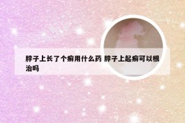 脖子上长了个癣用什么药 脖子上起癣可以根治吗