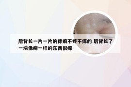 后背长一片一片的像癣不疼不痒的 后背长了一块像癣一样的东西很痒