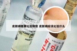 皮肤病需要化验哪些 皮肤病应该化验什么