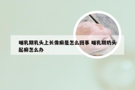 哺乳期乳头上长像癣是怎么回事 哺乳期奶头起癣怎么办