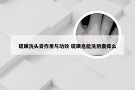 硫磺洗头膏作用与功效 硫磺皂能洗阴囊痒么