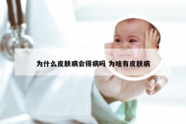 为什么皮肤病会得病吗 为啥有皮肤病