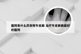 医院有什么药膏擦牛皮癣 治疗牛皮肤癣最好的医院
