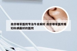 南京哪家医院专治牛皮癣好 南京哪家医院看妇科病最好的医院