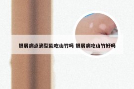 银屑病点滴型能吃山竹吗 银屑病吃山竹好吗