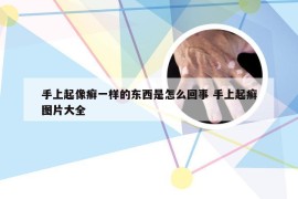 手上起像癣一样的东西是怎么回事 手上起癣图片大全